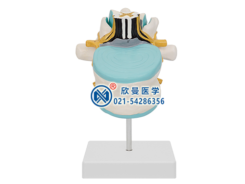 XM-624腰椎附脊髓與馬尾神經(jīng)放大模型