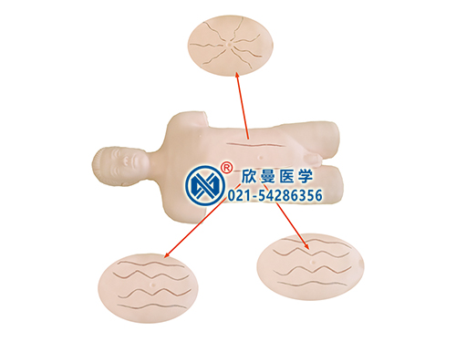 XM-HFB全自動(dòng)腹壁靜脈血流方向檢查技能訓(xùn)練標(biāo)準(zhǔn)化病人模型