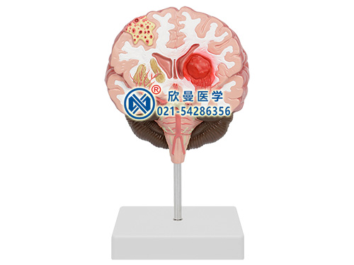 XM-610腦中風(fēng)模型,大腦疾病模型