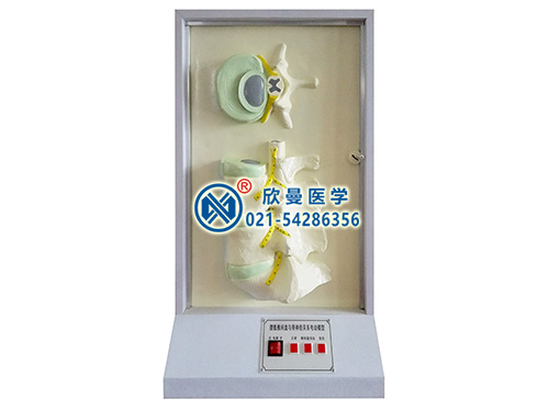 XM-D027腰骶椎、椎間盤和脊神經(jīng)關(guān)系電動模型